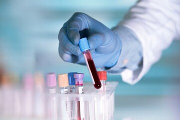 پیش‌بینی سرطان در مراحل اولیه با آزمایش خون