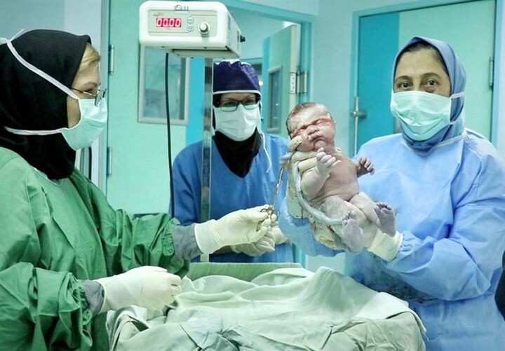 بدون مشارکت متخصصان زنان و زایمان قانون جوانی جمعیت قابلیت اجرا ندارد